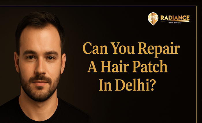 Can You Repair A Hair Patch In Delhi? Can You Repair A Hair Patch In Delhi?